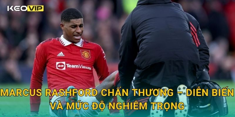 Marcus Rashford chấn thương khiến Man United lo lắng – cập nhật tại Keovip 1 Marcus Rashford chấn thương – Diễn biến và mức độ nghiêm trọng